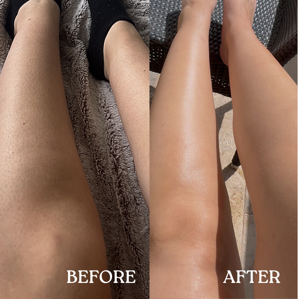 No Strawberry Legs Bundle