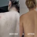 Exfoliating Backscrubber